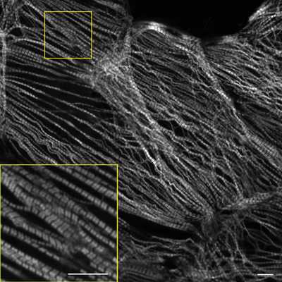 Cell line media